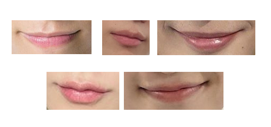 Adivina estos miembros de SHINee con solo mirar sus labios